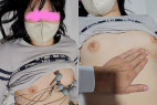 jkkfile02_tokuten 吸引具で真っ赤な跡が付いてしまったティーン患者の心電図検査。ピンク乳輪をもつおさな顔患者の胸を盗撮！