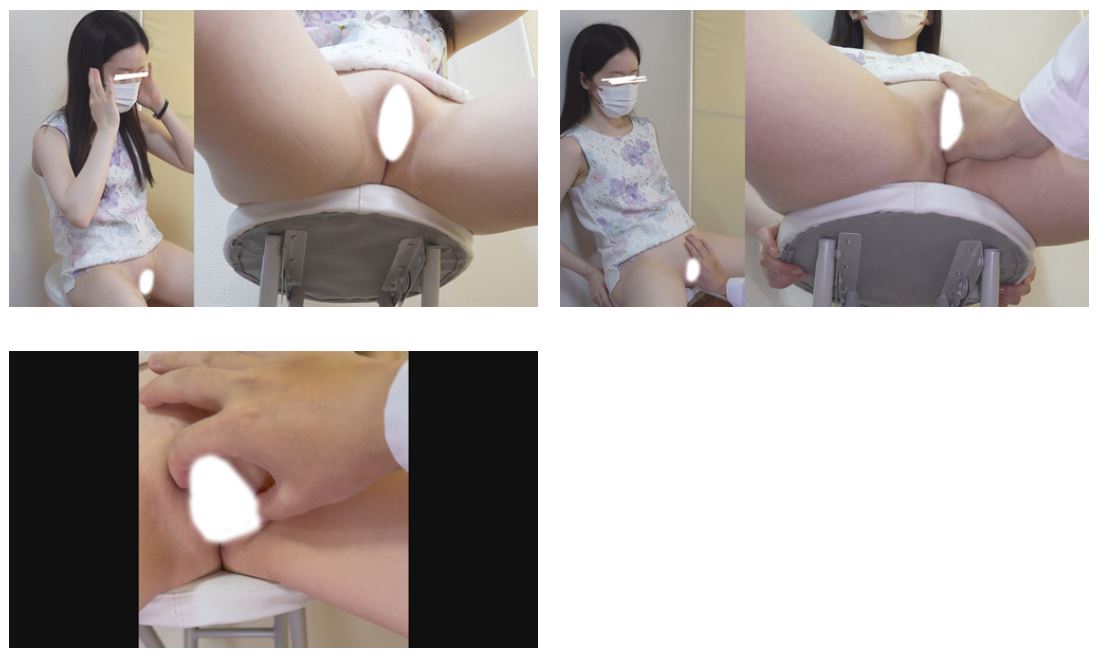 【一般外来/2画面】【後編】親指ズッポシ…！ビジュが坂アイドルでも膣内はキツキツ過ぎて握手拒否！？でも意外と肉厚でした。。。